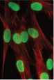 PRF-funded study Identifies Rapamycin as Possible Treatment for Progeria
