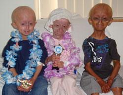 progeria research paper