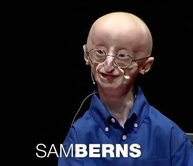 Sam Berns Ted Talk “My Philosophy for a Happy Life” over 25 Million 