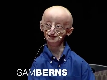 Sam Berns Ted Talk “My Philosophy for a Happy Life” over 25 Million