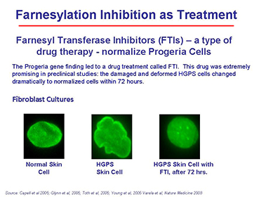 Lonafarnib Pre Clinical Drug Supply Program The Progeria