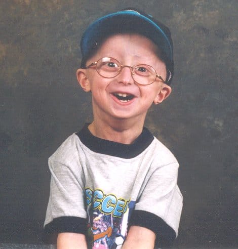 Our Story | The Progeria Research Foundation