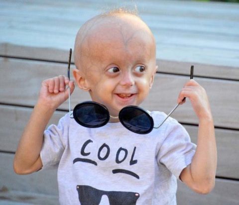 The Progeria Research Foundation | Together, We Will Find the Cure!